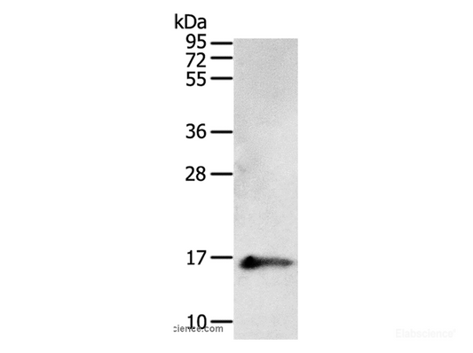Western Blot analysis of Human fetal brain tissue using PVALB Polyclonal Antibody at dilution of 1:400