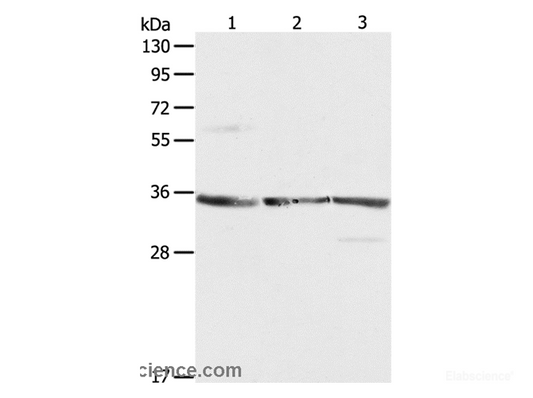 Western Blot analysis of NIH/3T3, A431 and Jurkat cell using RPLP0 Polyclonal Antibody at dilution of 1:750