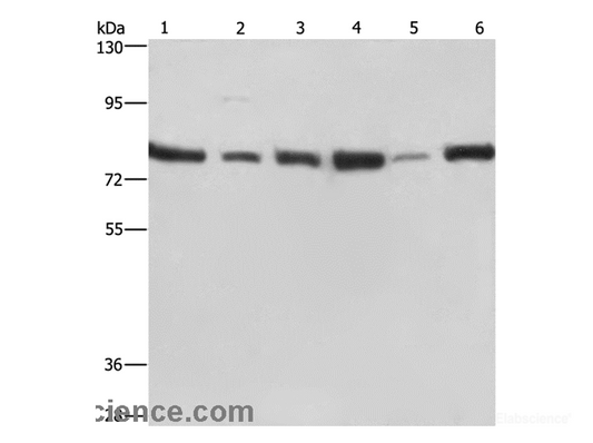 Western Blot analysis of Jurkat, 293T, Hela and K562 cell, Human testis tissue and A549 cell using SIRT1 Polyclonal Antibody at dilution of 1:500