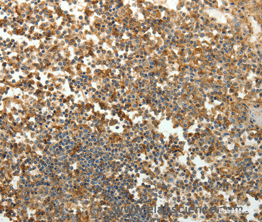 Immunohistochemistry of paraffin-embedded Human tonsil tissue using SFTPD Polyclonal Antibody at dilution 1:30