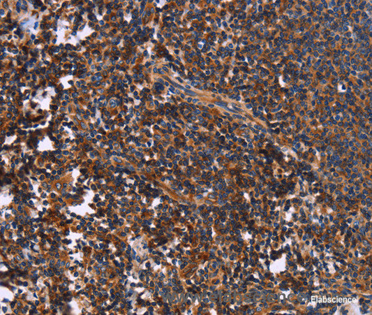 Immunohistochemistry of paraffin-embedded Human tonsil tissue using SYT4 Polyclonal Antibody at dilution 1:60