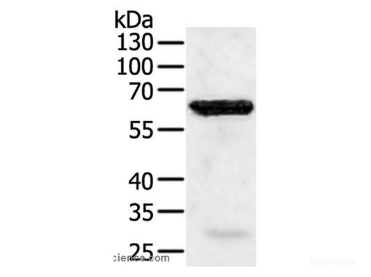 Western Blot analysis of Jurkat cell using TRAF5 Polyclonal Antibody at dilution of 1:450