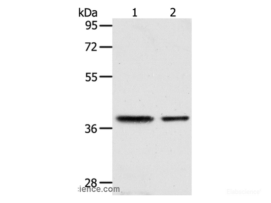 Western Blot analysis of Human fetal kidney and fetal muscle tissue using CNN3 Polyclonal Antibody at dilution of 1:400