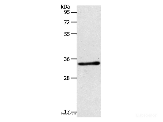 Western Blot analysis of Mouse kidney tissue using ACY3 Polyclonal Antibody at dilution of 1:500