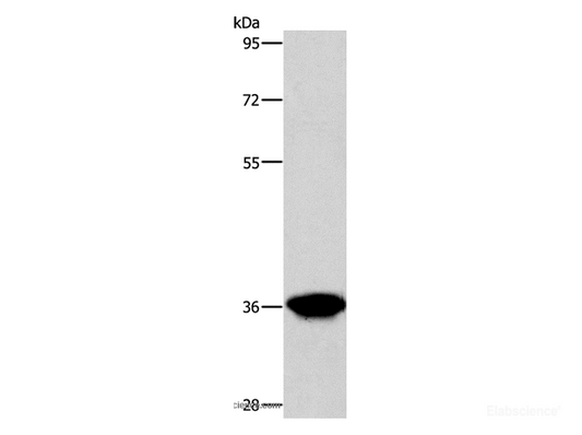Western Blot analysis of Human liver cancer tissue using AKR1D1 Polyclonal Antibody at dilution of 1:650