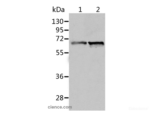 Western Blot analysis of Human fetal liver and liver cancer tissue using ALDH4A1 Polyclonal Antibody at dilution of 1:450