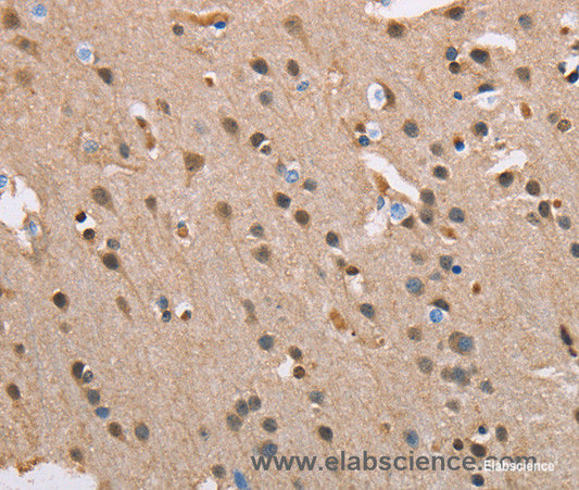 Immunohistochemistry of paraffin-embedded Human brain tissue using SERPINA1 Polyclonal Antibody at dilution 1:45