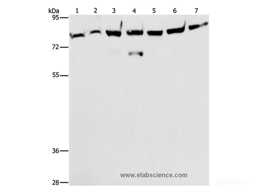 Western Blot analysis of A172 cell and Mouse brain tissue, K562, 231, A549, hela and hepG2 cell using PKC epsilon Polyclonal Antibody at dilution of 1:400