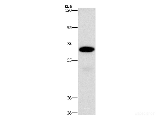 Western Blot analysis of A549 cell using CD73 Polyclonal Antibody at dilution of 1:850