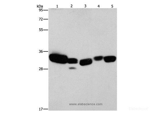 Western Blot analysis of Mouse liver and Human fetal lung tissue, hela cell and Mouse kidney tissue, Human brain malignant glioma tissue using CBR1 Polyclonal Antibody at dilution of 1:900