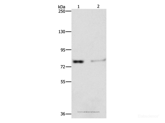 Western Blot analysis of Human fetal kidney tissue and 293T cell using ASAH2 Polyclonal Antibody at dilution of 1:240