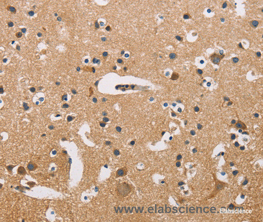 Immunohistochemistry of paraffin-embedded Human brain tissue using ATP2C1 Polyclonal Antibody at dilution 1:50