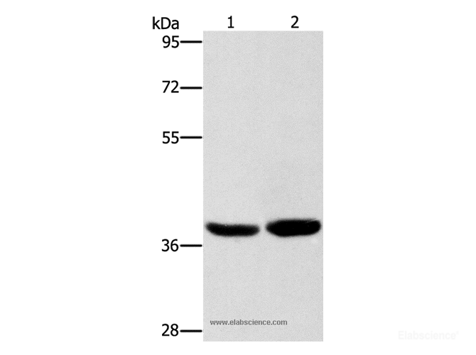 Western Blot analysis of Human fetal brain tissue and 231 cell using CAB39L Polyclonal Antibody at dilution of 1:400
