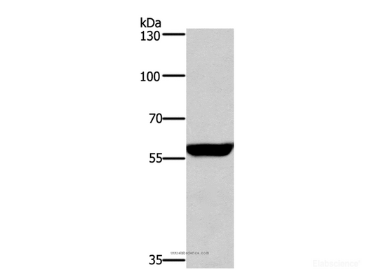 Western Blot analysis of Mouse brain tissue using PPP3CA Polyclonal Antibody at dilution of 1:650