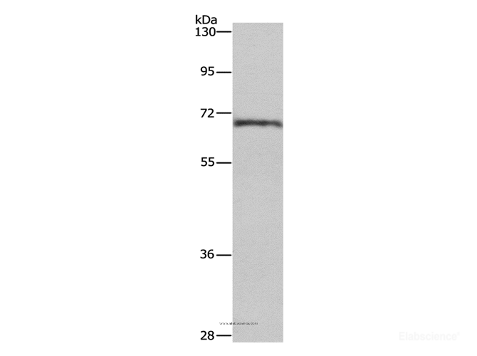 Western Blot analysis of Human normal liver tissue using HSF27 Polyclonal Antibody at dilution of 1:655