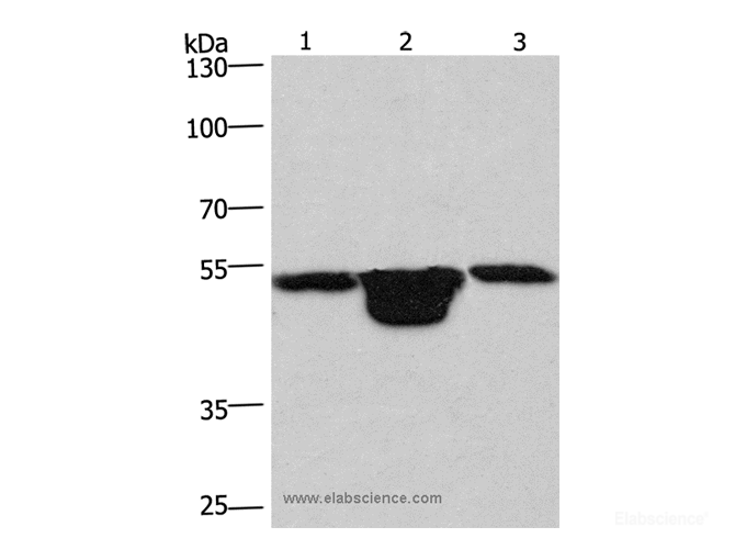 Western Blot analysis of Hela cell,  Mouse muscle and kidney tissue using PLEKHO1 Polyclonal Antibody at dilution of 1:200