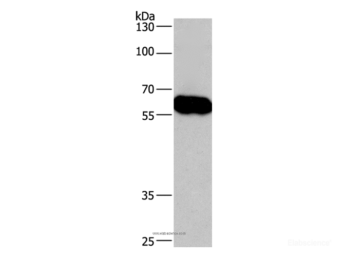 Western Blot analysis of Lovo cell  using CORO1C Polyclonal Antibody at dilution of 1:670