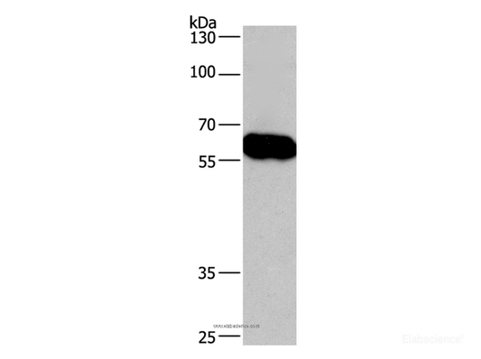 Western Blot analysis of Lovo cell  using CORO1C Polyclonal Antibody at dilution of 1:670