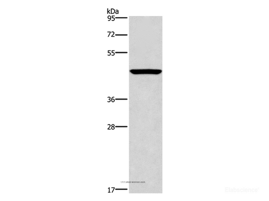 Western Blot analysis of Mouse pancreas tissue  using CPA2 Polyclonal Antibody at dilution of 1:500