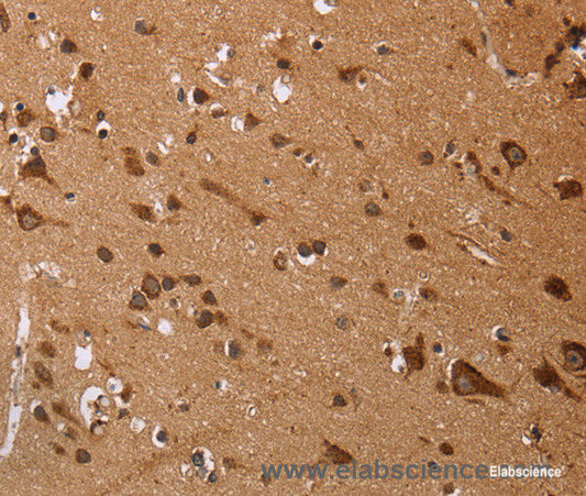 Immunohistochemistry of paraffin-embedded Human brain tissue using EDN3 Polyclonal Antibody at dilution 1:50