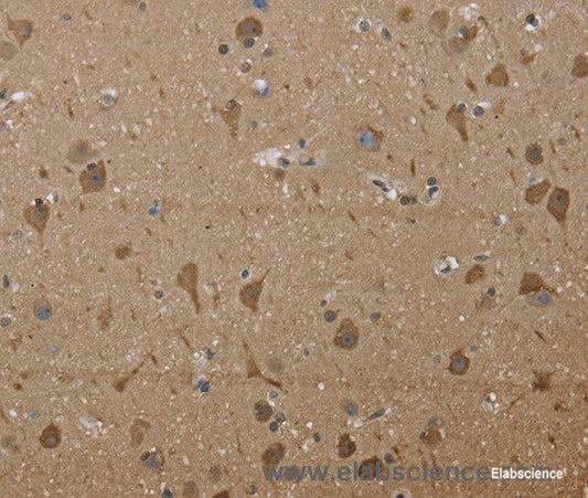 Immunohistochemistry of paraffin-embedded Human brain tissue using PTK2B Polyclonal Antibody at dilution 1:30