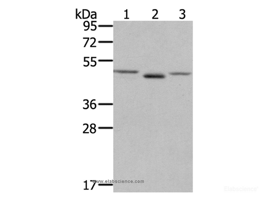 Western Blot analysis of NIH/3T3 cell and Human placenta tissue, lovo cell using FGFRL1 Polyclonal Antibody at dilution of 1:400