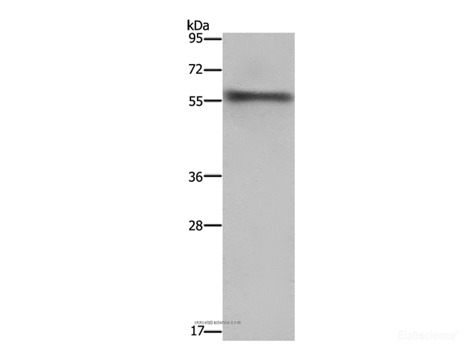 Western Blot analysis of Mouse heart tissue using FKBP8 Polyclonal Antibody at dilution of 1:1000