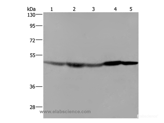 Western Blot analysis of Hela cell, Mouse liver, brain and heart tissue, RAW264.7 cell using FH Polyclonal Antibody at dilution of 1:600