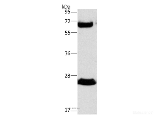 Western Blot analysis of Human fetal liver tissue using GGT1 Polyclonal Antibody at dilution of 1:300