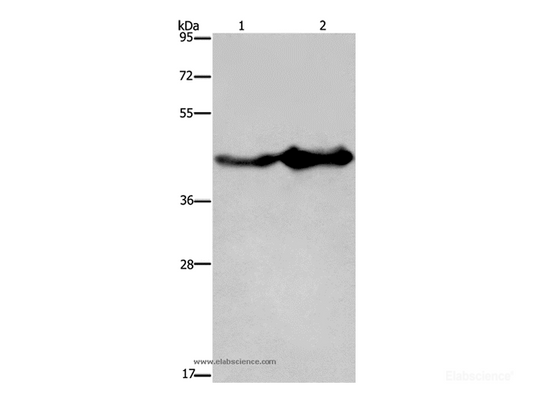 Western Blot analysis of Mouse liver and brain tissue using GLUL Polyclonal Antibody at dilution of 1:600
