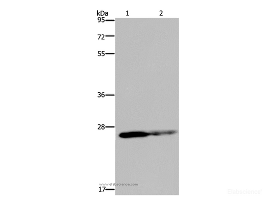 Western Blot analysis of HT-29 cell and Human fetal brain tissue using GSTP1 Polyclonal Antibody at dilution of 1:350