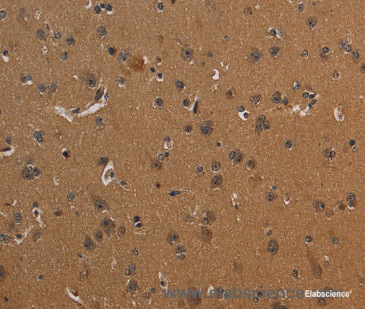 Immunohistochemistry of paraffin-embedded Human brain tissue using CD242 Polyclonal Antibody at dilution 1:30