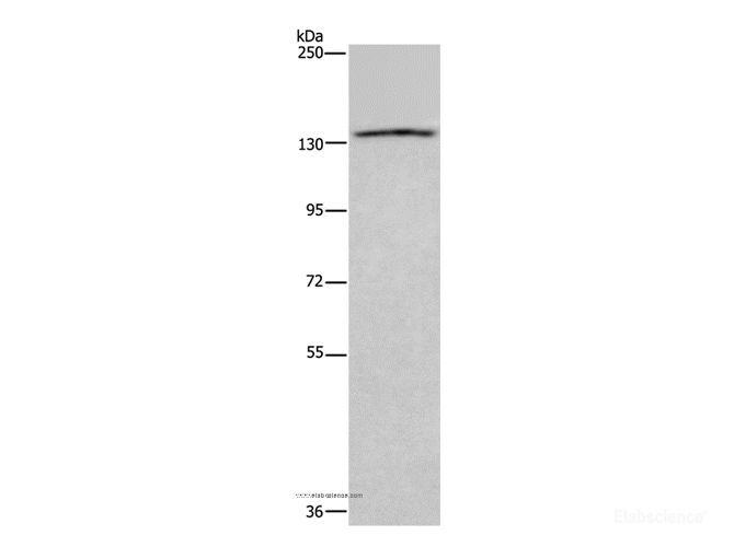 Western Blot analysis of  LoVo cells using ITGAE Polyclonal Antibody at dilution of 1:550