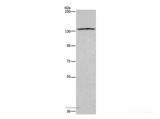 Western Blot analysis of  LoVo cells using ITGAE Polyclonal Antibody at dilution of 1:550