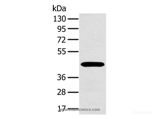 Western Blot analysis of A375 cell using MAGEA10 Polyclonal Antibody at dilution of 1:400