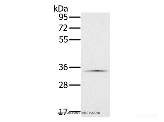 Western Blot analysis of Hela cell using NDUFA9 Polyclonal Antibody at dilution of 1:400
