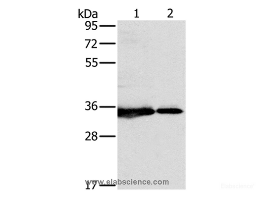 Western Blot analysis of 231 and Jurkat cell using NDUFAF1 Polyclonal Antibody at dilution of 1:500