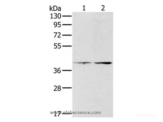 Western Blot analysis of Hela and lovo cell using PDGFRL Polyclonal Antibody at dilution of 1:400