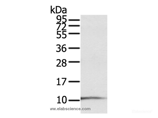 Western Blot analysis of A431 cell using S100P Polyclonal Antibody at dilution of 1:600