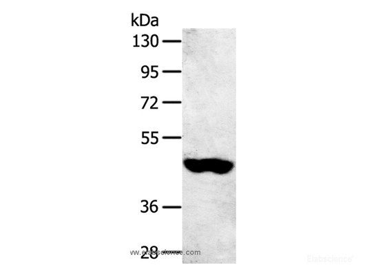 Western Blot analysis of 231 cell using SULT2B1 Polyclonal Antibody at dilution of 1:800