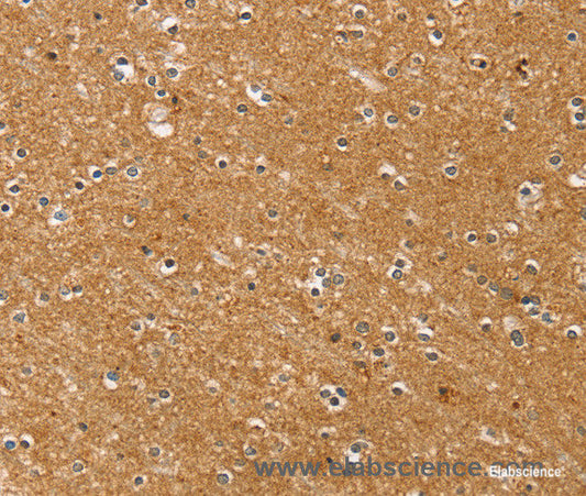 Immunohistochemistry of paraffin-embedded Human brain tissue using SYTL5 Polyclonal Antibody at dilution 1:50