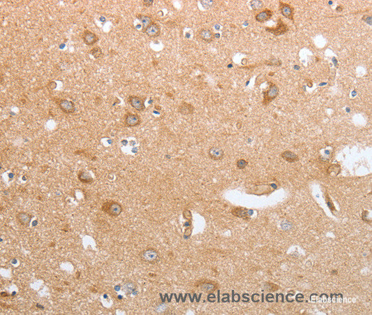 Immunohistochemistry of paraffin-embedded Human brain tissue using CASP12 Polyclonal Antibody at dilution 1:50