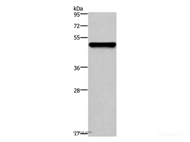 Western Blot analysis of Mouse skin tissue using CK-14 Polyclonal Antibody at dilution of 1:1000