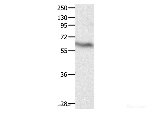 Western Blot analysis of Huamn fetal brain tissue using CRMP3 Polyclonal Antibody at dilution of 1:500