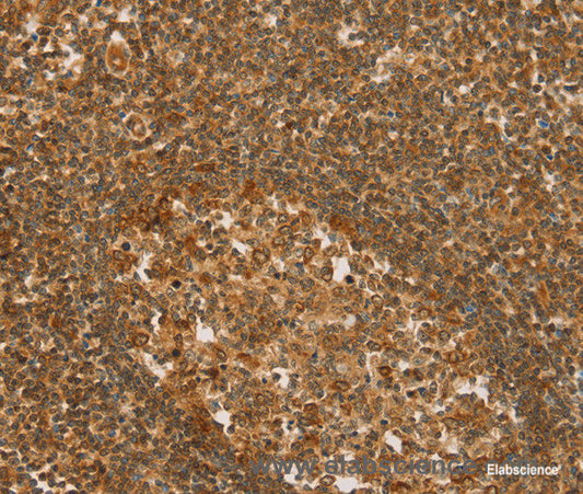 Immunohistochemistry of paraffin-embedded Human tonsil tissue using SLC6A3 Polyclonal Antibody at dilution 1:50