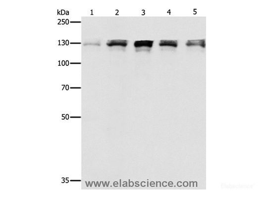 Western Blot analysis of Human fetal small intestine, liver cancer and Lymphoma Lymphoma, 293T and A549 cell using DDB1 Polyclonal Antibody at dilution of 1:500