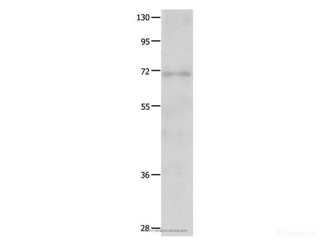Western Blot analysis of Human fetal lung tissue   using IGF2BP1 Polyclonal Antibody at dilution of 1:500