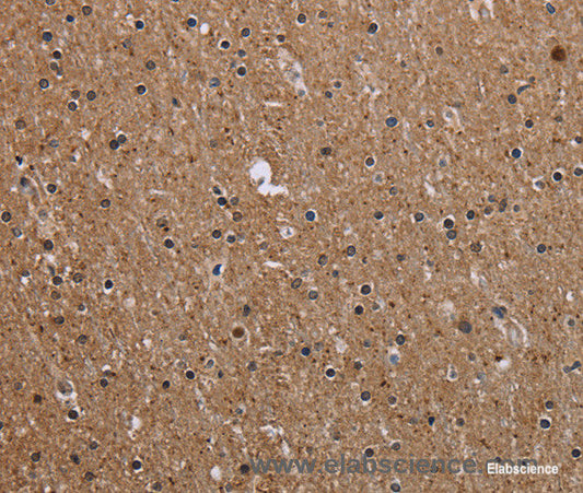 Immunohistochemistry of paraffin-embedded Human brain tissue using CMTM5 Polyclonal Antibody at dilution 1:40
