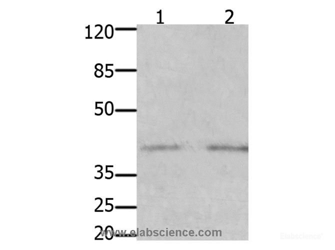 Western Blot analysis of Human fetal kidney and  brain tissue using GFRA3 Polyclonal Antibody at dilution of 1:1000