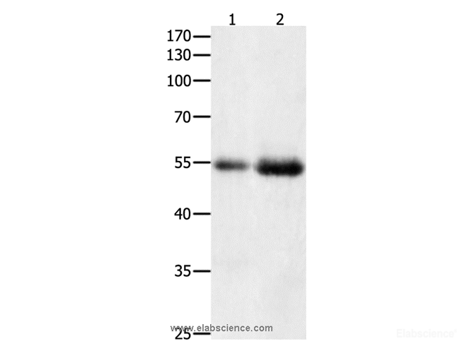 Western Blot analysis of Human colon  and  kidney cancer tissue   using HDAC1 Polyclonal Antibody at dilution of 1:400